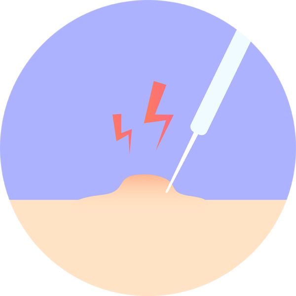 Treating Basal Cell Carcinoma Treatment Options Skin Cancer