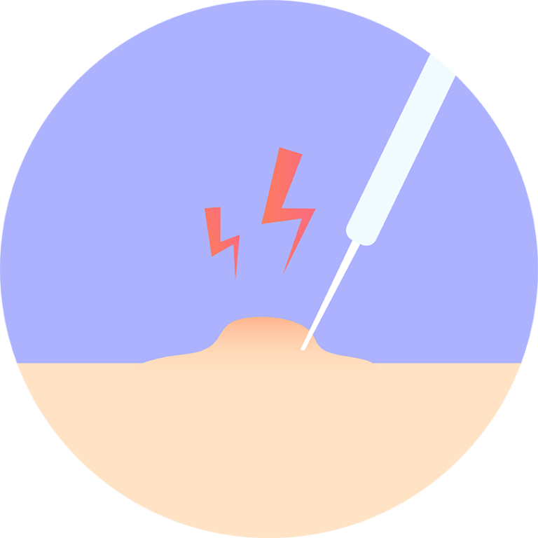 Treating Squamous Cell Skin Cancer Treatment Options Skin Cancer